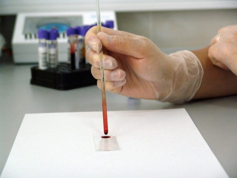 Medische afbeelding van een bloedonderzoek procedure met naald en bloedmonster